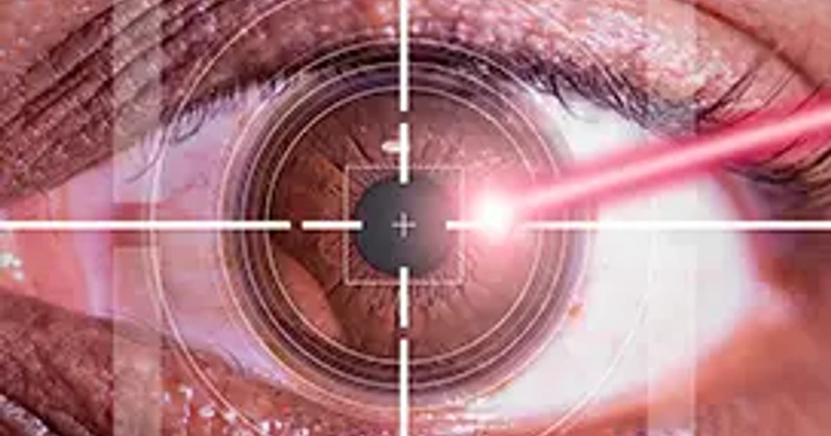 Laser vision correction — refractive eye surgery diagram